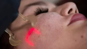 Além do espelho: lasers dermatológicos influenciam a biologia e estimulam a longevidade da pele